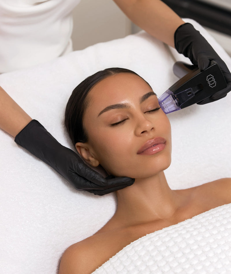 Morpheus8 RF Skin Needling