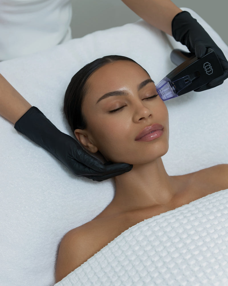 Morpheus8 RF Skin Needling